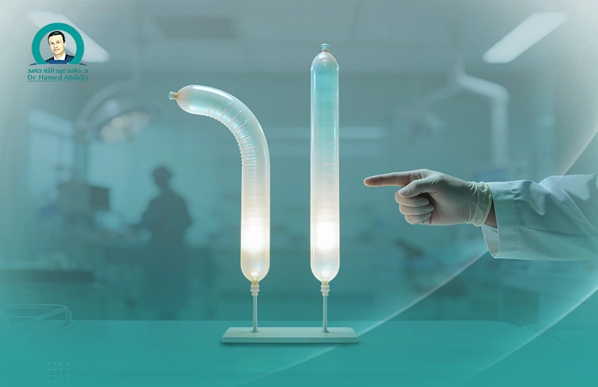 علاج اعوجاج القضيب